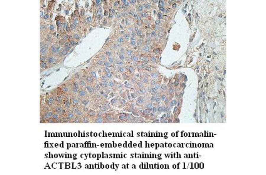 ACTBL3 Antibody from Signalway Antibody (39429) - Antibodies.com