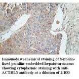 ACTBL3 Antibody from Signalway Antibody (39429) - Antibodies.com