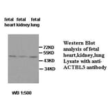 ACTBL3 Antibody from Signalway Antibody (39429) - Antibodies.com
