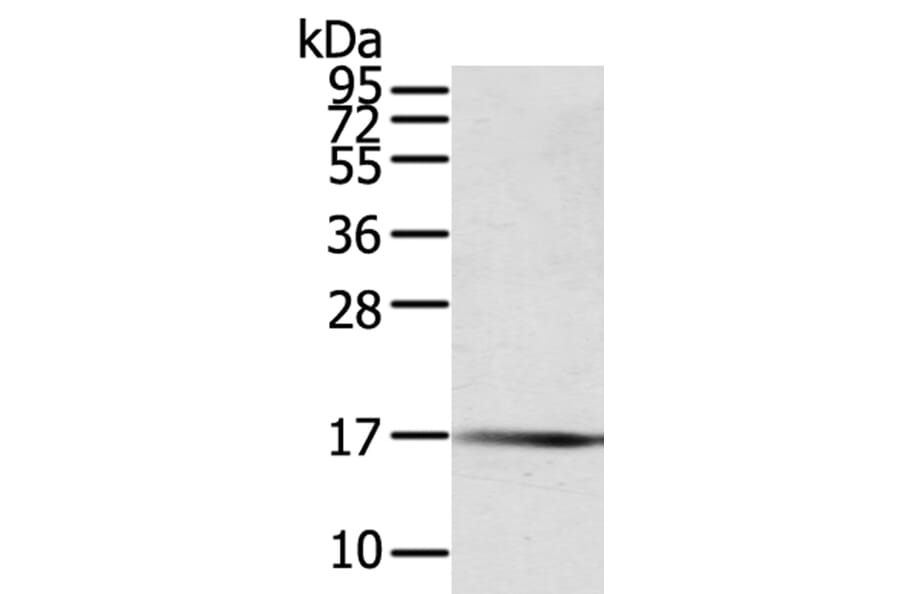 PTPMT1 Antibody from Signalway Antibody (40065) - Antibodies.com