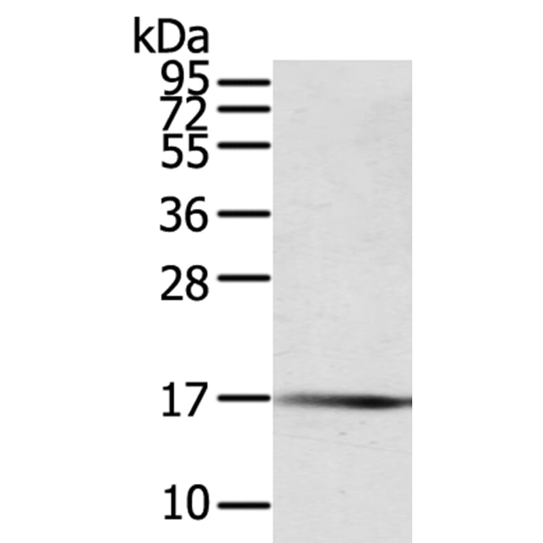 PTPMT1 Antibody from Signalway Antibody (40065) - Antibodies.com