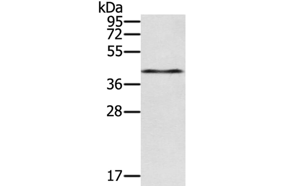 RASSF4 Antibody from Signalway Antibody (40071) - Antibodies.com