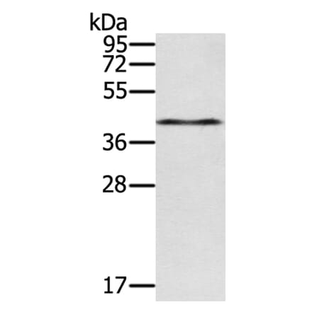 RASSF4 Antibody from Signalway Antibody (40071) - Antibodies.com