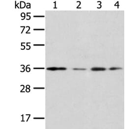 HOXD13 Antibody from Signalway Antibody (40183) - Antibodies.com