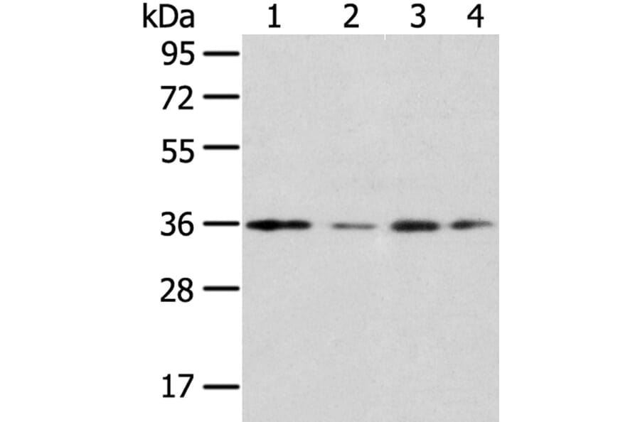 HOXD13 Antibody from Signalway Antibody (40183) - Antibodies.com