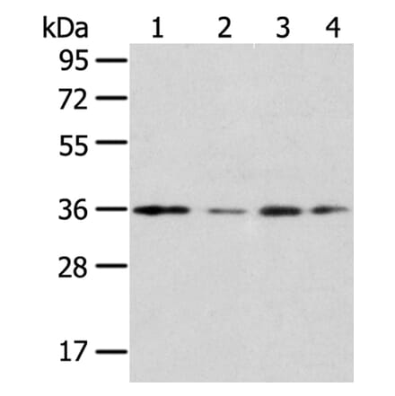 HOXD13 Antibody from Signalway Antibody (40183) - Antibodies.com