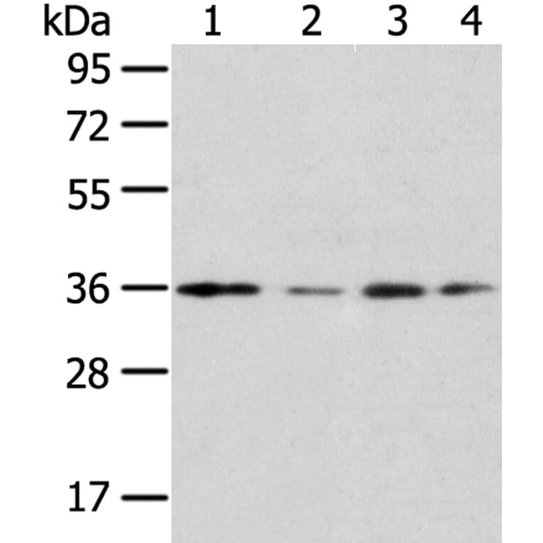 HOXD13 Antibody from Signalway Antibody (40183) - Antibodies.com