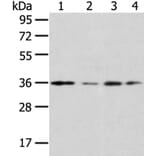 HOXD13 Antibody from Signalway Antibody (40183) - Antibodies.com