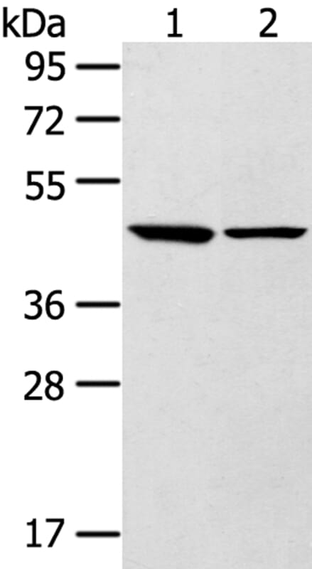 Gel: 8% SDS-PAGE Lysates (from left to right): Mouse brain and liver tissue. Amount of lysate: 40ug per lane Primary antibody: 1/250 dilution Secondary antibody dilution: 1/8000Exposure time: 10 seconds