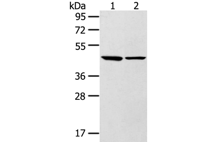 LTB4R2 Antibody from Signalway Antibody (40200) - Antibodies.com