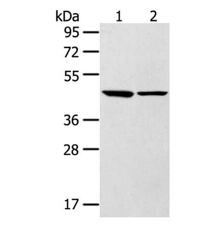 LTB4R2 Antibody from Signalway Antibody (40200) - Antibodies.com