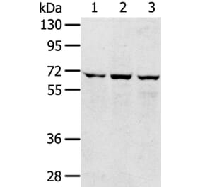 SLC5A9 Antibody from Signalway Antibody (40214) - Antibodies.com