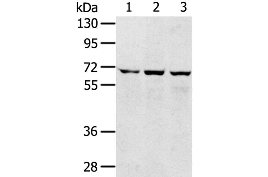 SLC5A9 Antibody from Signalway Antibody (40214) - Antibodies.com