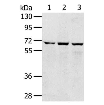 SLC5A9 Antibody from Signalway Antibody (40214) - Antibodies.com