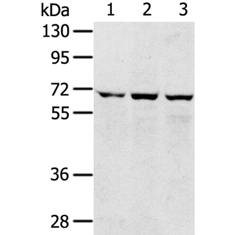 SLC5A9 Antibody from Signalway Antibody (40214) - Antibodies.com