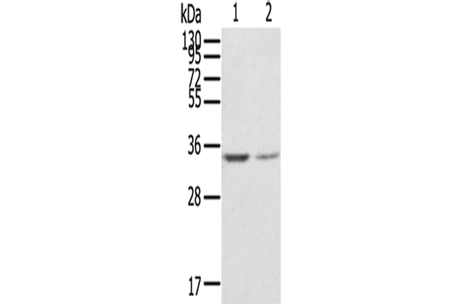 GNB2L1 Antibody from Signalway Antibody (42727) - Antibodies.com