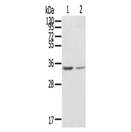 GNB2L1 Antibody from Signalway Antibody (42727) - Antibodies.com