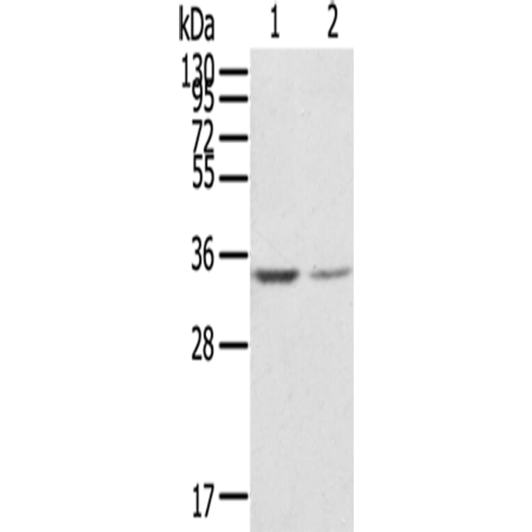 GNB2L1 Antibody from Signalway Antibody (42727) - Antibodies.com