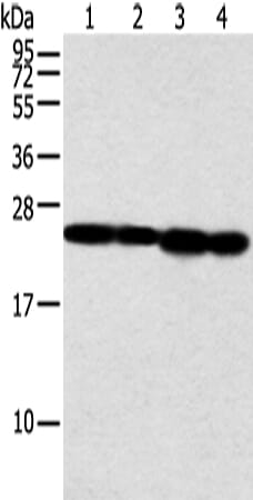 Gel: 12% SDS-PAGE Lysate: 40 &#956;g Lane 1-4: Jurkat and A549 cell, human fetal liver tissue and hela cell Primary antibody: 1/350 dilution Secondary antibody: Goat anti rabbit IgG at 1/8000 dilution Exposure time: 5 seconds