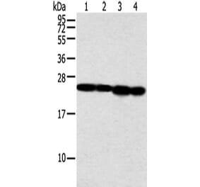 NDUFB9 Antibody from Signalway Antibody (42883) - Antibodies.com