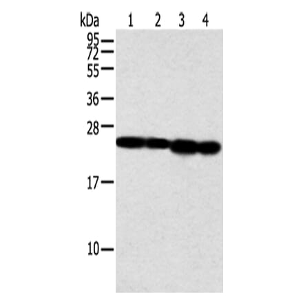 NDUFB9 Antibody from Signalway Antibody (42883) - Antibodies.com