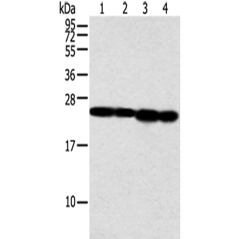 NDUFB9 Antibody from Signalway Antibody (42883) - Antibodies.com