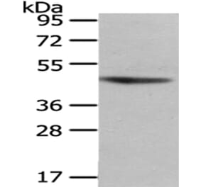 NHLRC1 Antibody from Signalway Antibody (43080) - Antibodies.com