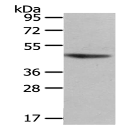 NHLRC1 Antibody from Signalway Antibody (43080) - Antibodies.com