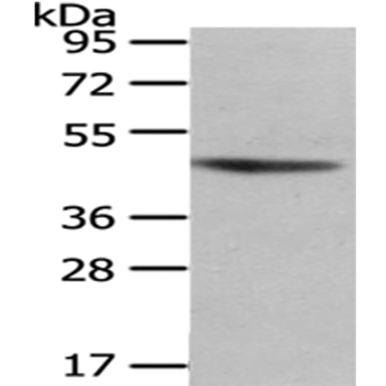 NHLRC1 Antibody from Signalway Antibody (43080) - Antibodies.com