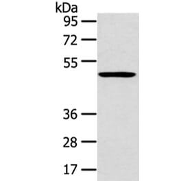 HTRA1 Antibody from Signalway Antibody (43120) - Antibodies.com