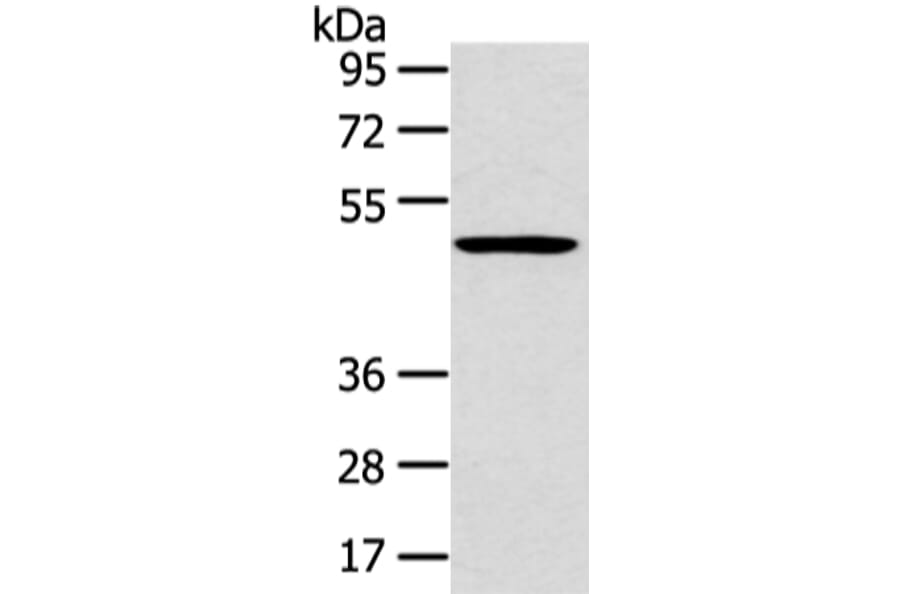 HTRA1 Antibody from Signalway Antibody (43120) - Antibodies.com