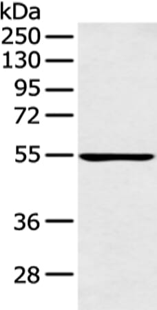 Gel: 8% SDS-PAGE Lysate: 40 &#956;g Lane: Raji cell Primary antibody: 1/300 dilution Secondary antibody: Goat anti rabbit IgG at 1/8000 dilution Exposure time: 1 minute