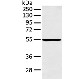 PFKFB4 Antibody from Signalway Antibody (43126) - Antibodies.com