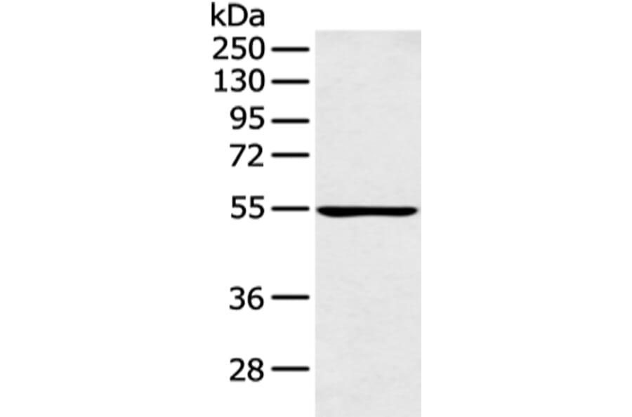 PFKFB4 Antibody from Signalway Antibody (43126) - Antibodies.com