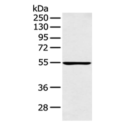 PFKFB4 Antibody from Signalway Antibody (43126) - Antibodies.com