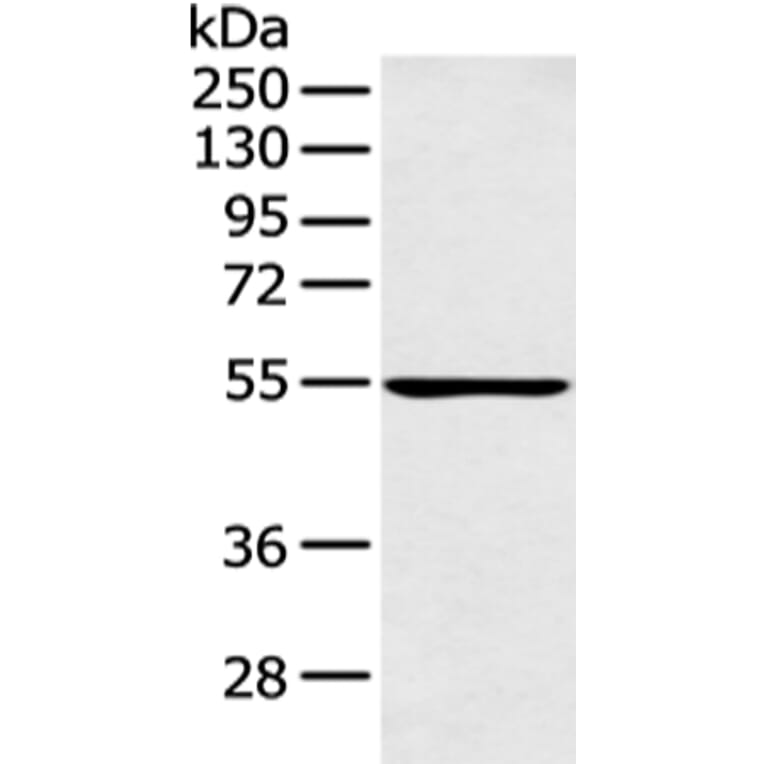 PFKFB4 Antibody from Signalway Antibody (43126) - Antibodies.com