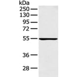 PFKFB4 Antibody from Signalway Antibody (43126) - Antibodies.com