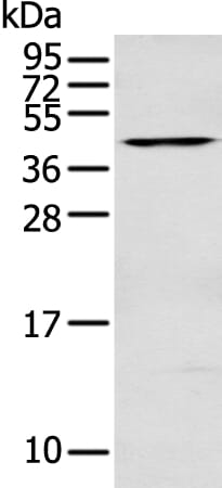 Gel: 12% SDS-PAGE Lysate: 40 &#956;g Lane: HEPG2 cell Primary antibody: 1/200 dilution Secondary antibody: Goat anti rabbit IgG at 1/8000 dilution Exposure time: 1MIN