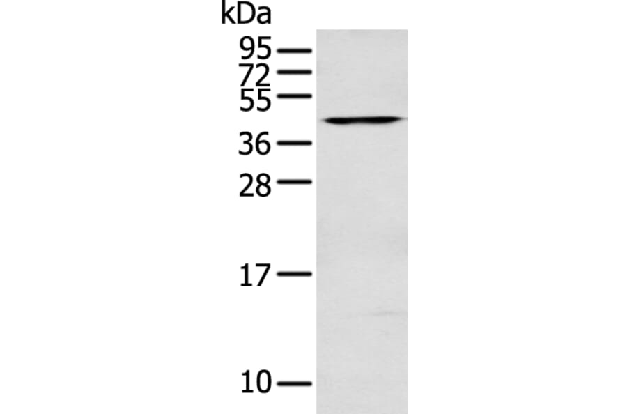 DNASE2 Antibody from Signalway Antibody (43130) - Antibodies.com