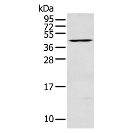 DNASE2 Antibody from Signalway Antibody (43130) - Antibodies.com