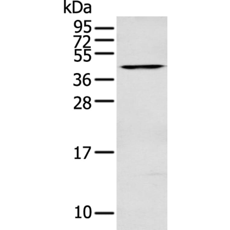 DNASE2 Antibody from Signalway Antibody (43130) - Antibodies.com