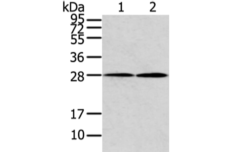 KCNMB1 Antibody from Signalway Antibody (43133) - Antibodies.com