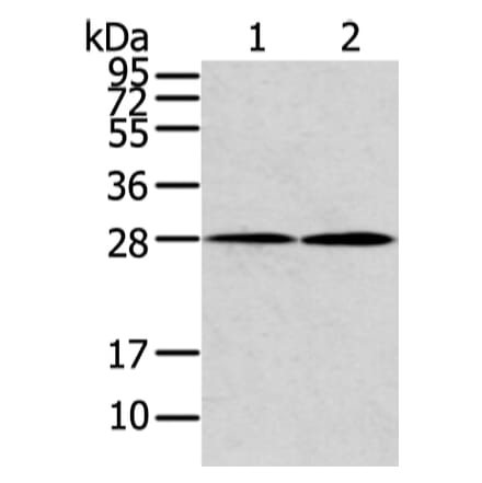 KCNMB1 Antibody from Signalway Antibody (43133) - Antibodies.com