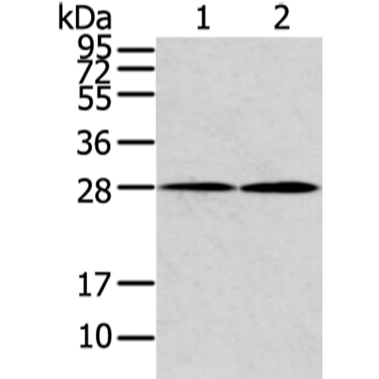 KCNMB1 Antibody from Signalway Antibody (43133) - Antibodies.com