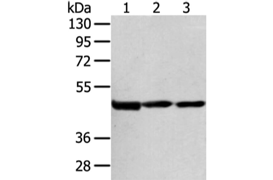 AGPAT9 Antibody from Signalway Antibody (43137) - Antibodies.com