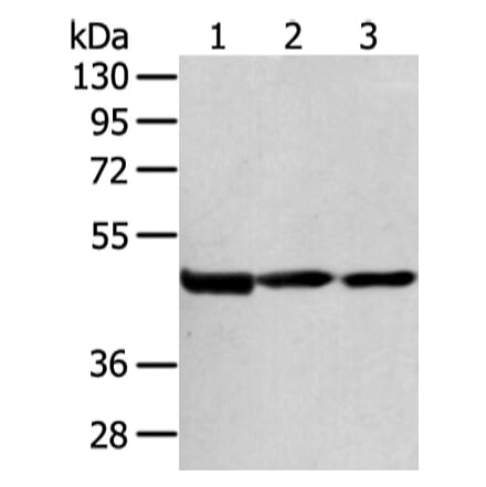 AGPAT9 Antibody from Signalway Antibody (43137) - Antibodies.com