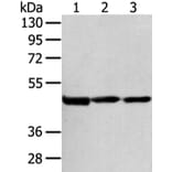 AGPAT9 Antibody from Signalway Antibody (43137) - Antibodies.com