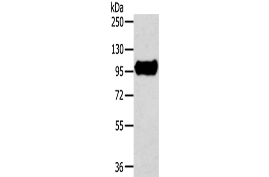 TRIM71 Antibody from Signalway Antibody (43161) - Antibodies.com