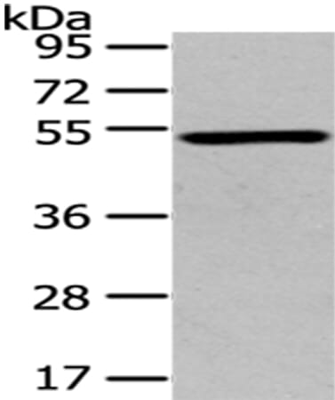 Gel: 8% SDS-PAGE Lysate: 40 &#956;g Lane: Mouse brain tissue Primary antibody: 1/200 dilution Secondary antibody: Goat anti rabbit IgG at 1/8000 dilution Exposure time: 2 minutes