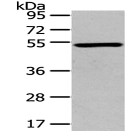 TSPYL1 Antibody from Signalway Antibody (43171) - Antibodies.com